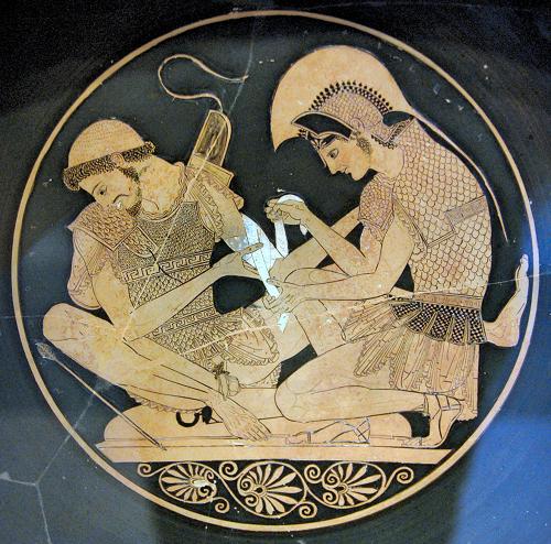 Achille et Patrocle.