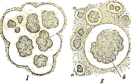 Zooglée d'Ascococcus Billrothii .